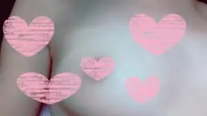 陥没乳首　エース